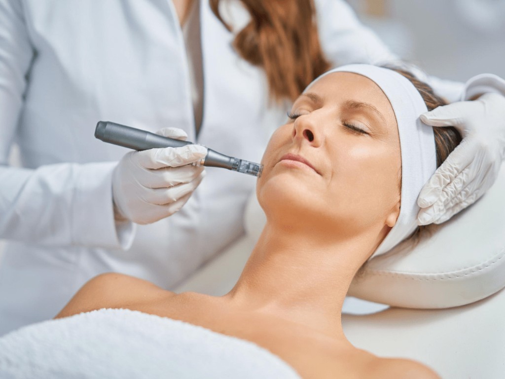 Educational illustration of microneedling. Not a verified patient photograph.