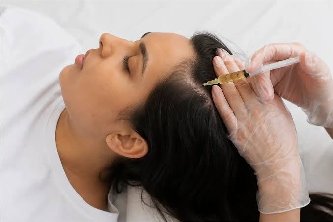 Educational illustration of PRP hair treatment. Not a verified patient photograph.