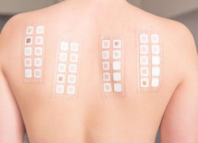 Allergy Patch Test in Pune