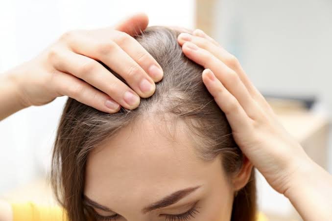 Alopecia Areata Treatment in Pune