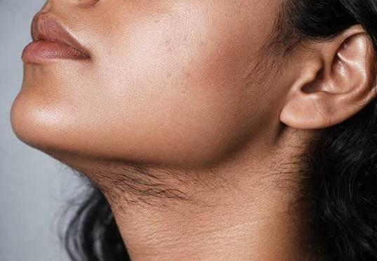 Excess Hair Growth Treatment in Pune