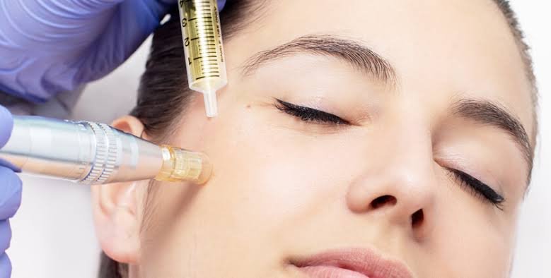 Mesotherapy Treatment in Pune