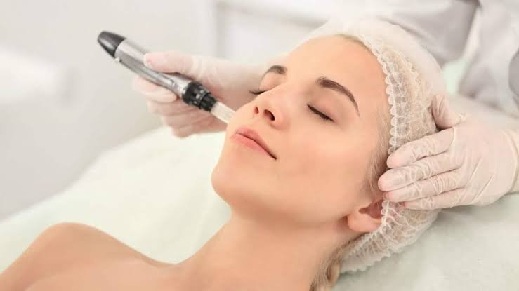 Microneedling By Dermapen in Pune