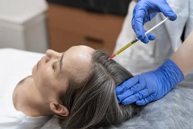 PRP Hair Treatment in Pune