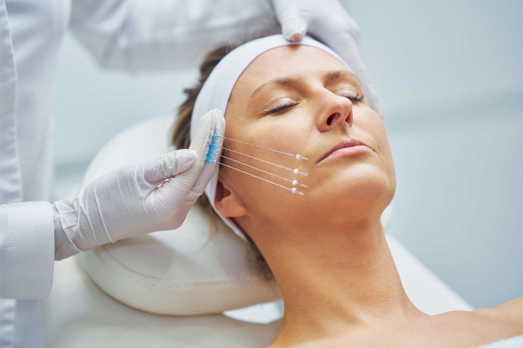 Thread Lift Treatment in Pune
